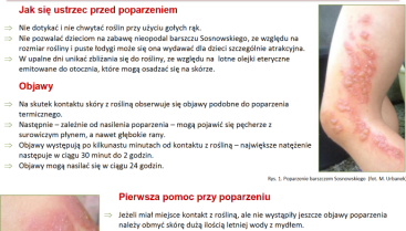 Poparzenia Barszczem Sosnowskiego